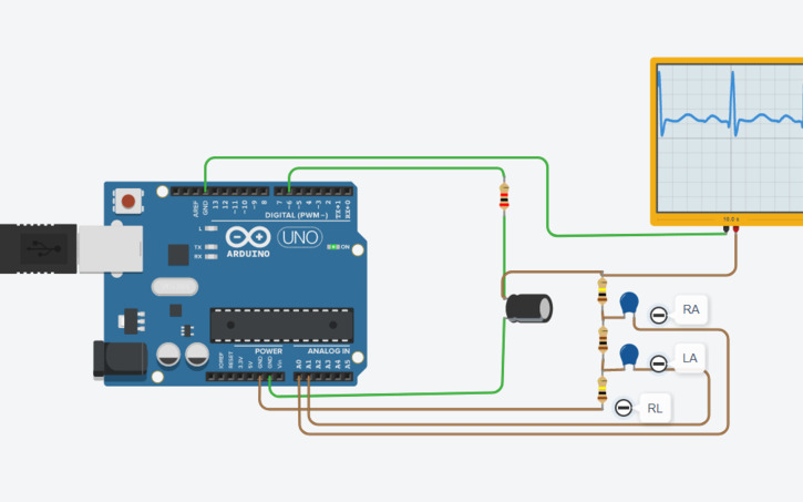Circuit design Simple ECG Simulator - Tinkercad